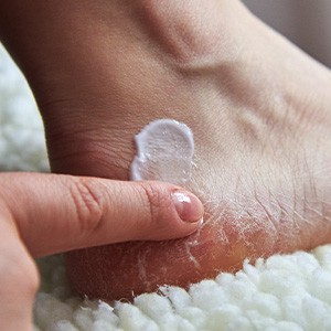 crema piedi