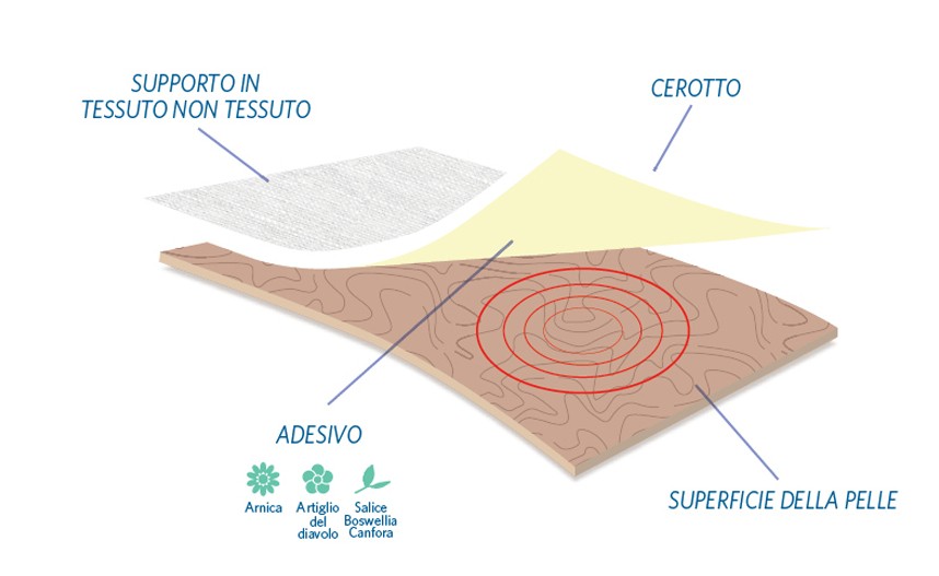 cerotto dream patch sixtus